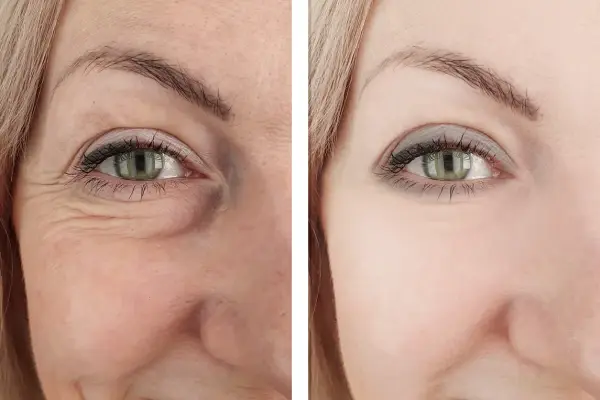 Aplicativo-Gratis-Rejuvenescedor-Conheca-os-3-Melhores